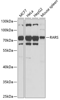 RARS antibody