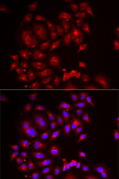 SLC26A2 antibody