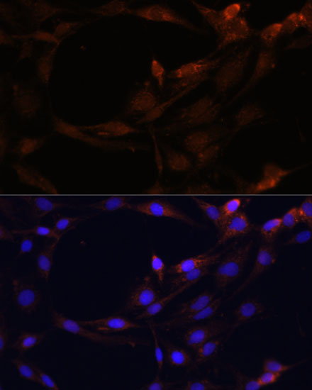 SERPINB9 antibody