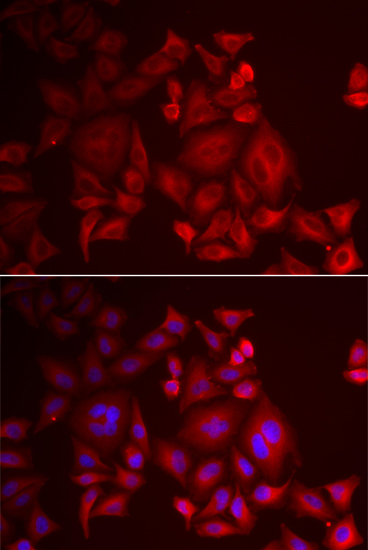 XCL1 antibody