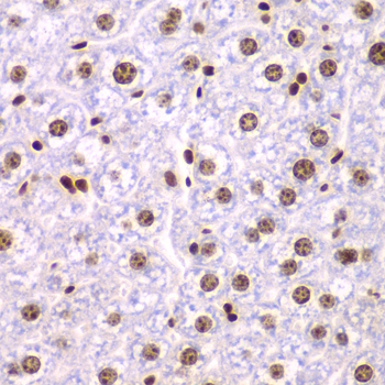 SSRP1 antibody