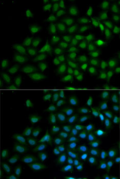 KLF10 antibody