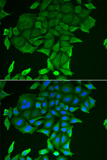 CD84 antibody