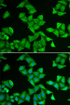 COX5A antibody