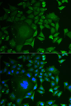 C1D antibody