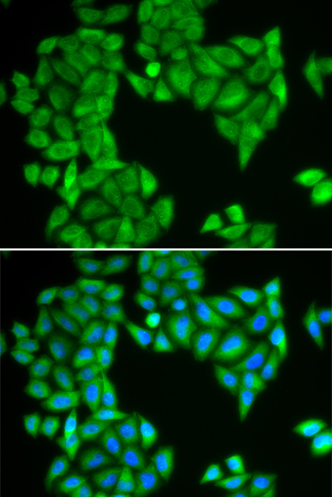 SPAG5 antibody