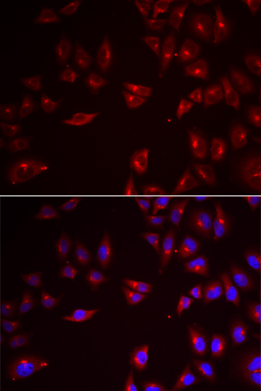 PRAME antibody