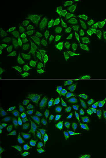 RHOD antibody