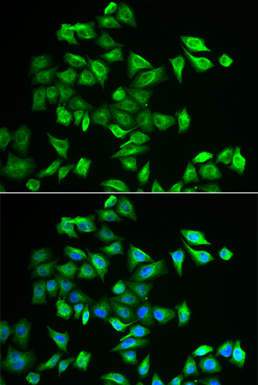 POMGNT2 antibody