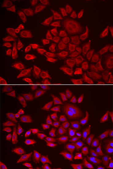 AGPAT2 antibody