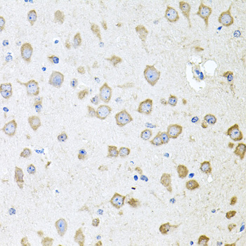 AKAP5 antibody