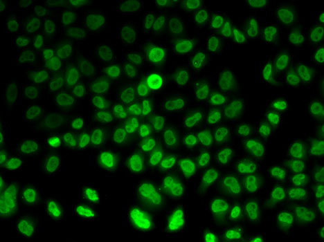 ASMT antibody