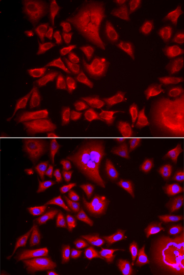 BLMH antibody