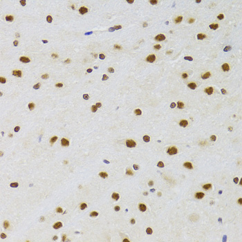 CSRP3 antibody