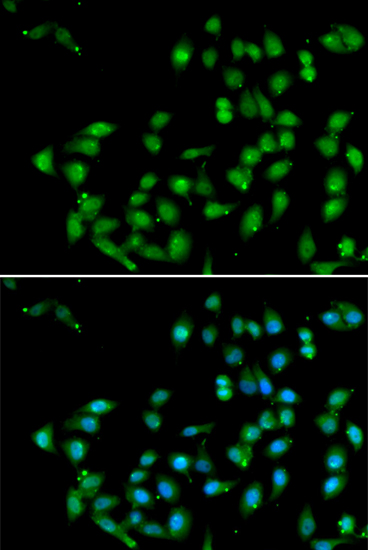 CTNNBL1 antibody