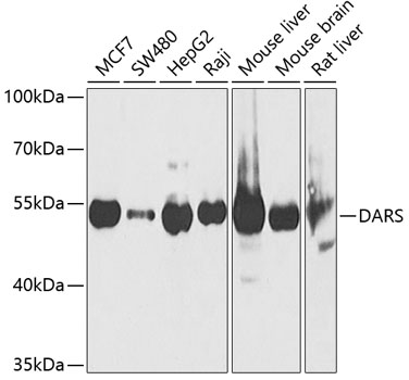 DARS antibody