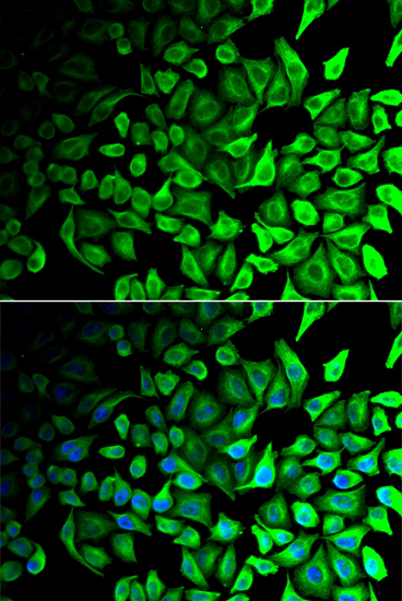 DPP7 antibody