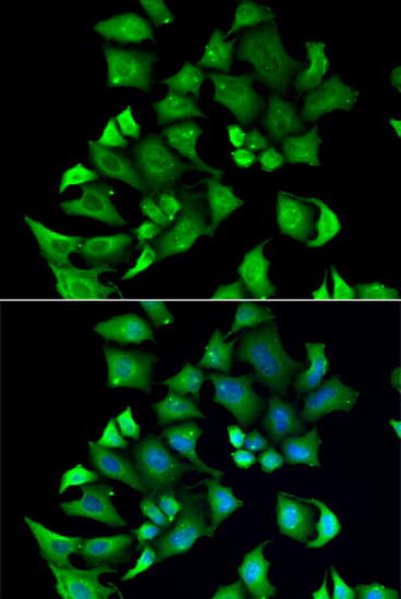 ENTPD2 antibody