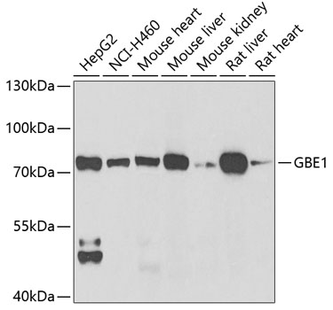 GBE1 antibody