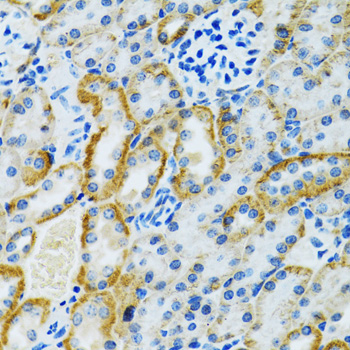 GDAP1 antibody