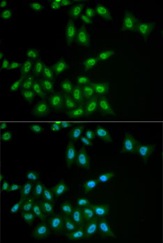 HPS1 antibody