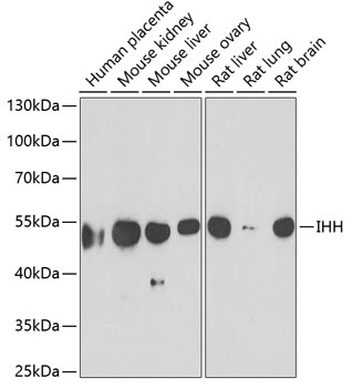 IHH antibody