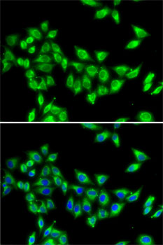 KIF3A antibody