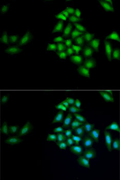 KLK4 antibody