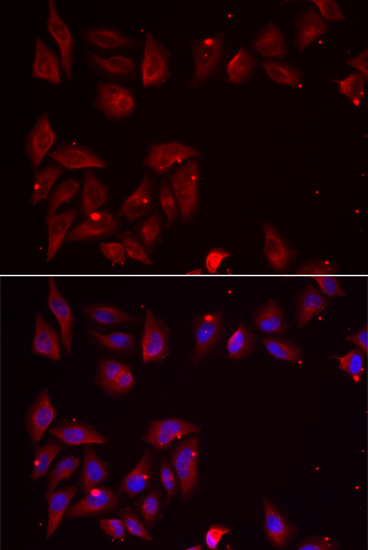 PDXK antibody