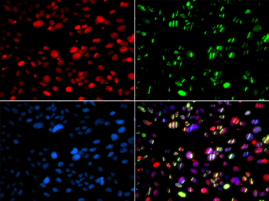 PNKP antibody