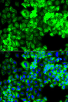 SARS antibody