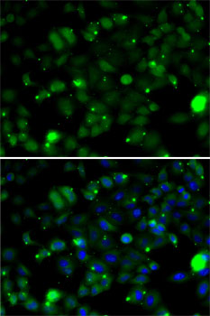 TAGLN2 antibody