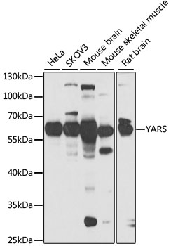 YARS antibody