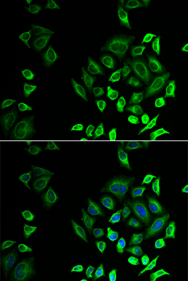 PLA2G2D antibody