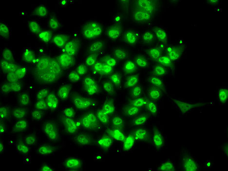 SMYD3 antibody