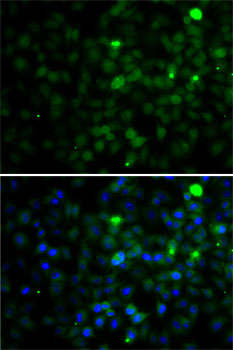 SMYD4 antibody