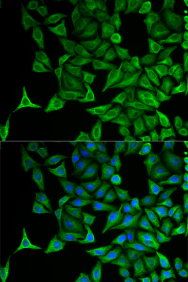 KRT20 Antibody