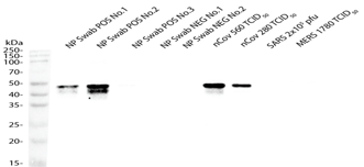 Anti-Nucleocapsid (N) Rabbit Monoclonal Antibody