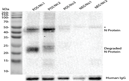 Anti-Nucleocapsid (N) Rabbit Monoclonal Antibody