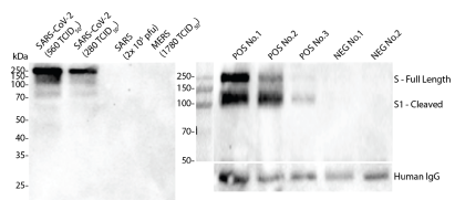 Anti-Spike (S) Mouse Monoclonal Antibody