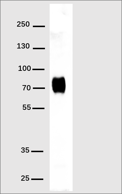 Anti-His Tag Antibody(DM1), Rabbit mAb