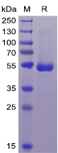 Human CD70 Protein, mFc-His Tag