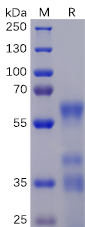 Human BTLA Protein, mFc-His Tag