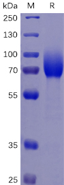 Human CSF1R Protein, His Tag