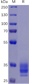 Human EPCAM Protein, His Tag