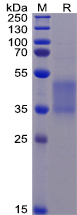 Human FCGR3A Protein, His Tag