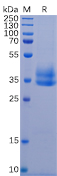 Human IL2RB Protein, His Tag