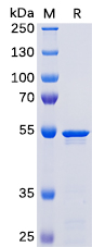 SARS-CoV-2 (2019-nCoV) Nucleocapsid, His Tag