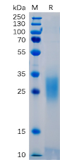 Human PD-1 Protein,  His tag