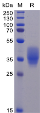 Human CD200 Protein, His Tag